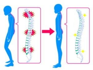 【春日部のやぎはし整体院】春日部で「パーキンソン病の腰痛」専門の治療・整体