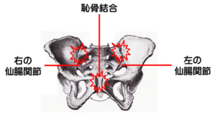 【春日部のやぎはし整体院】春日部で産前・産後の「骨盤の歪み」専門の整体