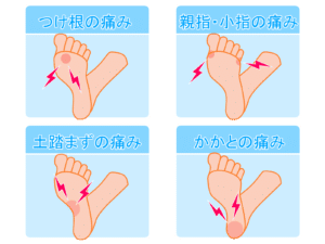 【春日部のやぎはし整体院】春日部で「踵骨骨端炎（踵骨骨端症）（セバー病）」専門の整体