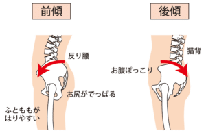 【春日部のやぎはし整体院】春日部で「反り腰」専門の整体院