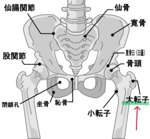 【春日部のやぎはし整体院】大腿骨大転子疼痛症候群の整体方法（薬を使わず、手術なしで治す方法）