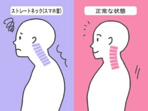 【春日部の整体】ストレートネックをしっかり根本改善する”芸能人”も通う凄腕揃いの整体院
